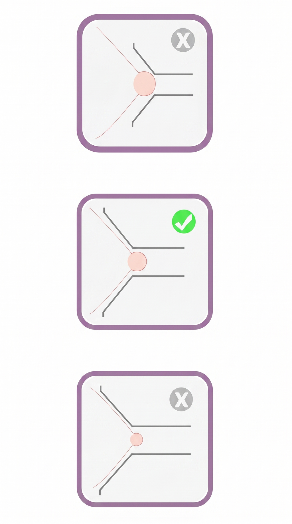 Nursaya Breast Pump Flanges - Medical-Grade Silicone, Custom Sizing for Maximum Comfort