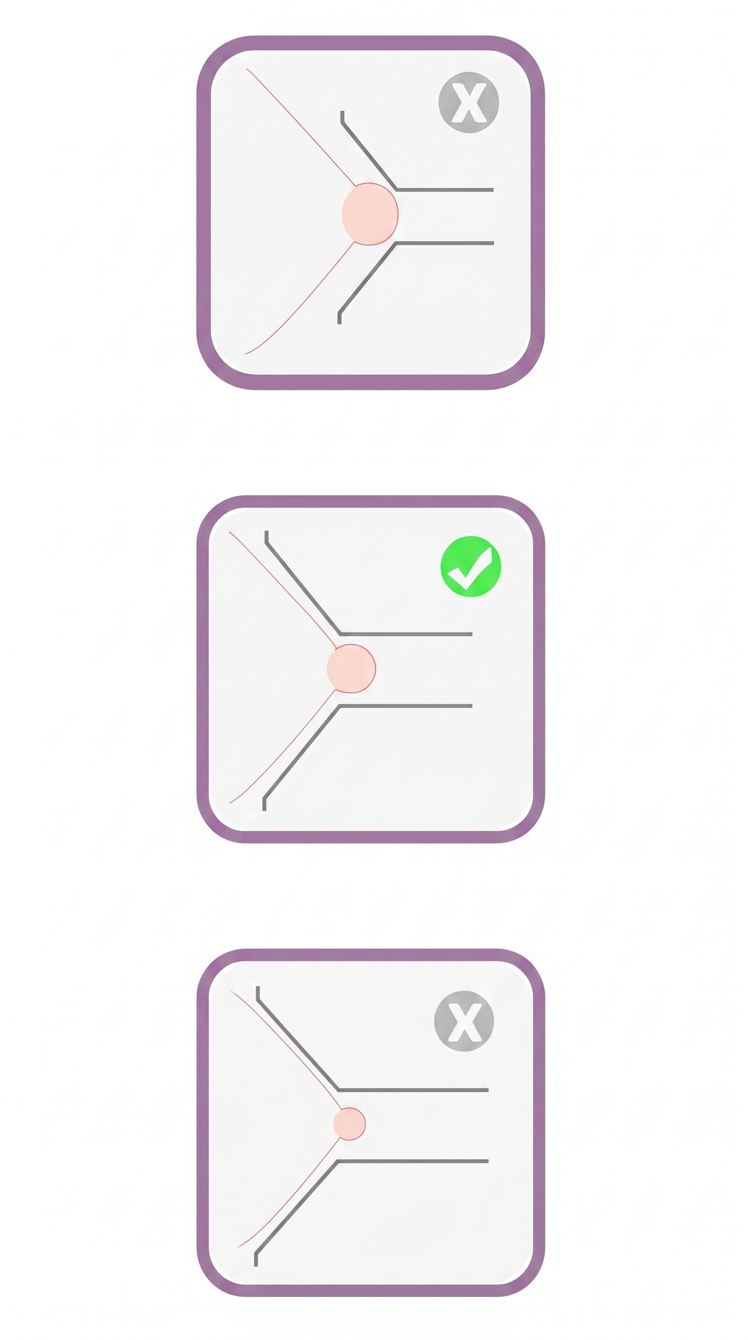 Nursaya Breast Pump Flanges - Medical-Grade Silicone, Custom Sizing for Maximum Comfort